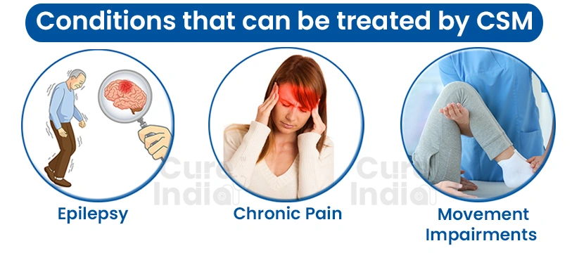 Reasons for Cortical Stimulation Surgery in India